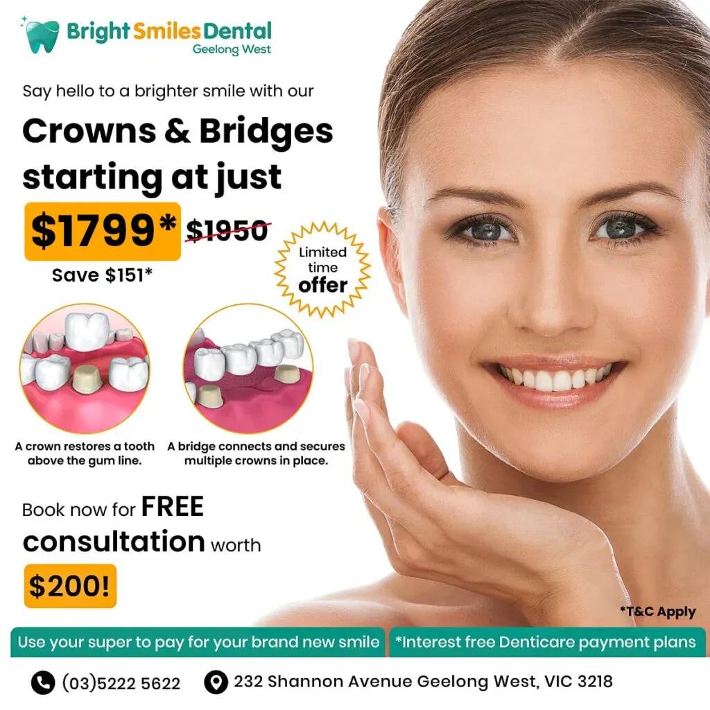 crowns-bridges-offer