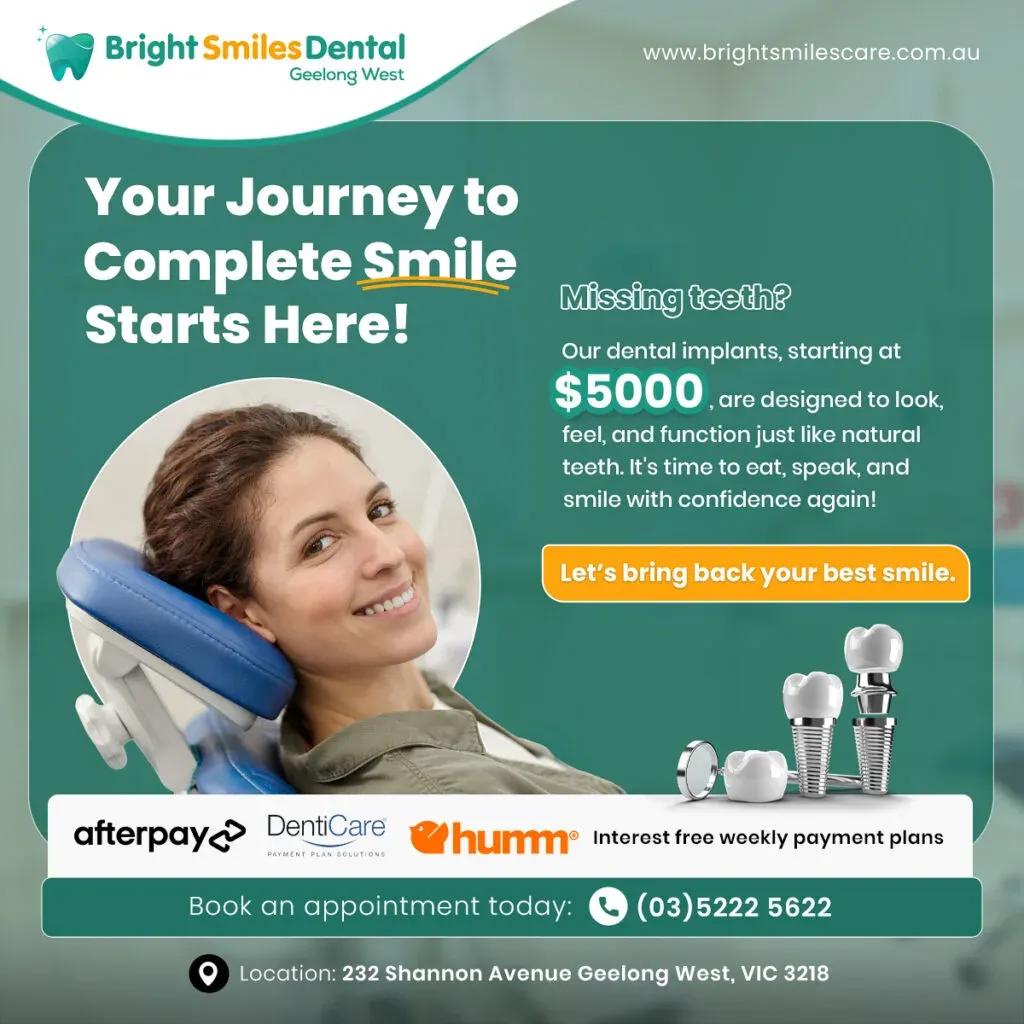 dental-implants-offer