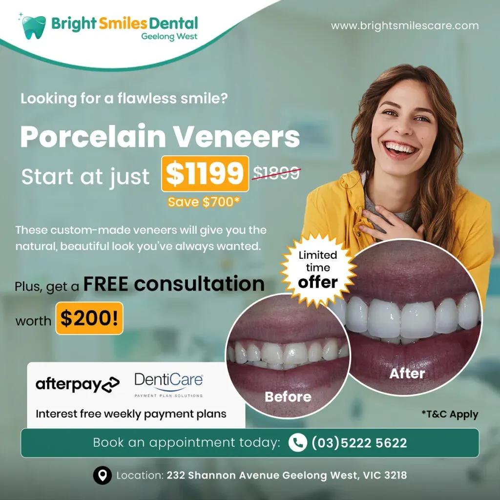 porcelain-veneers-offer