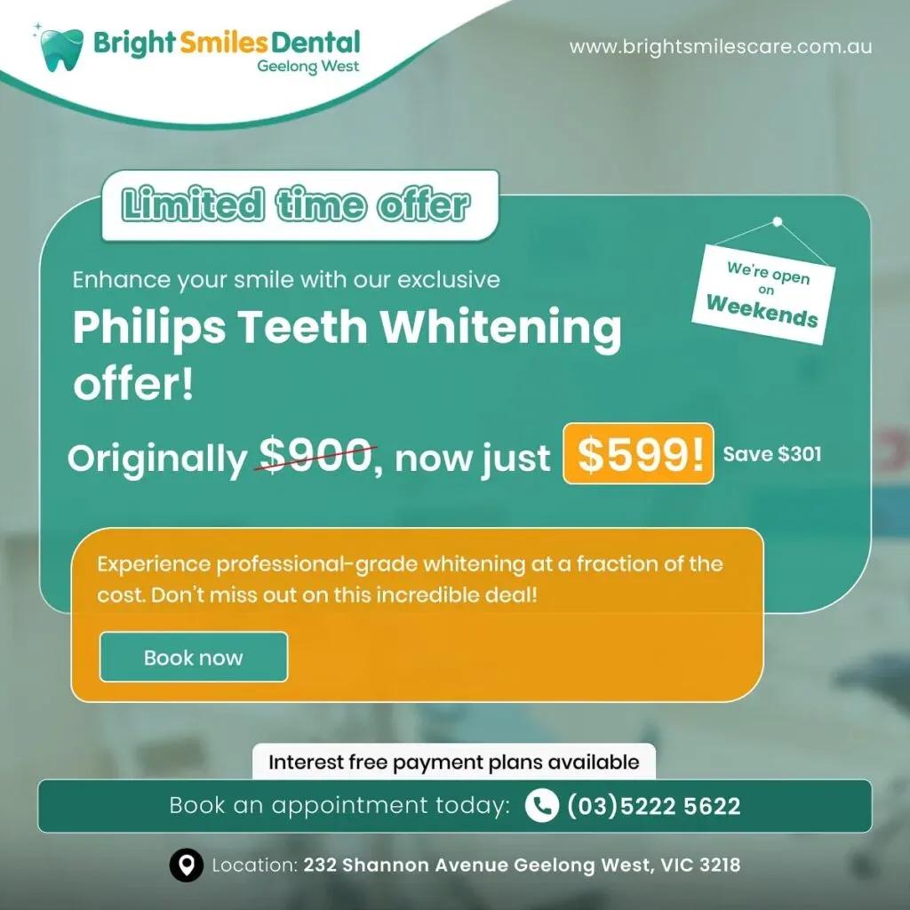 teeth-whitening-offer