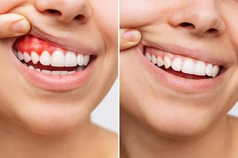 bright-smile