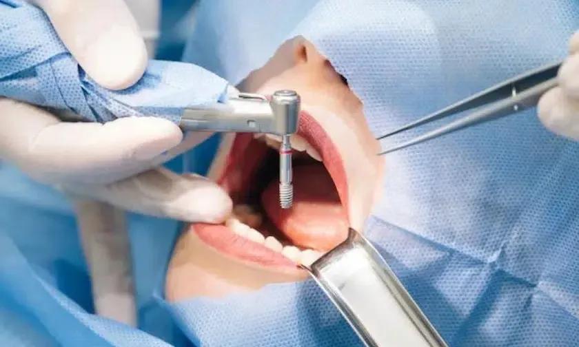 procedure