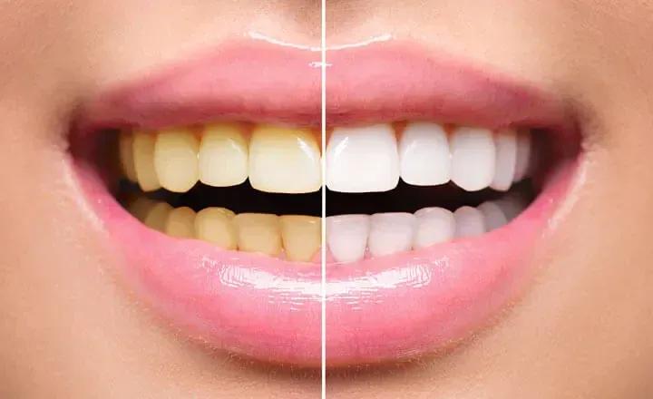 before-after