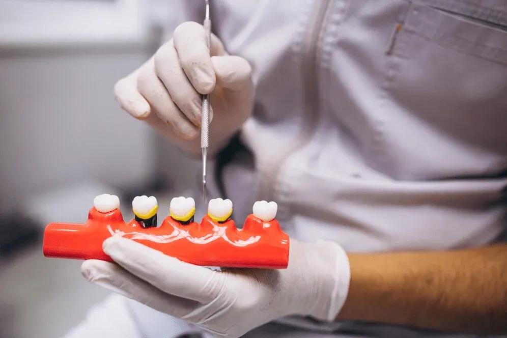 dental-crowns-shade-tray-996x664