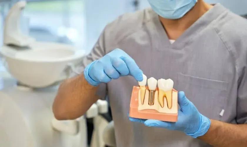 implant-model