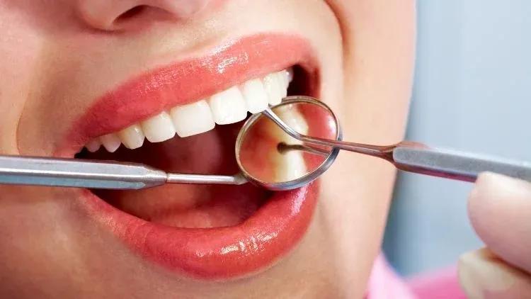types-of-dental-bridges-750x422