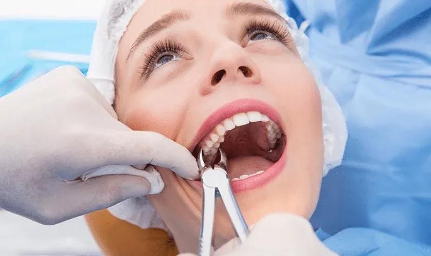 wisdom-teeth-extraction-840x500