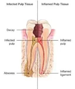 tooth-anatomy