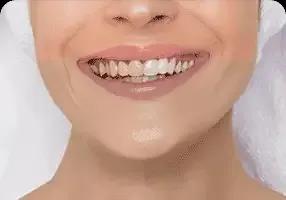 cosmetic-dentistry