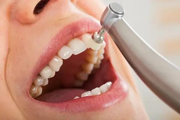 general-dentistry