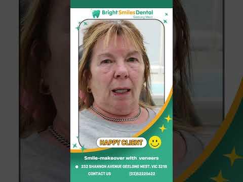 Transform Your Smile with Cosmetic Veneers