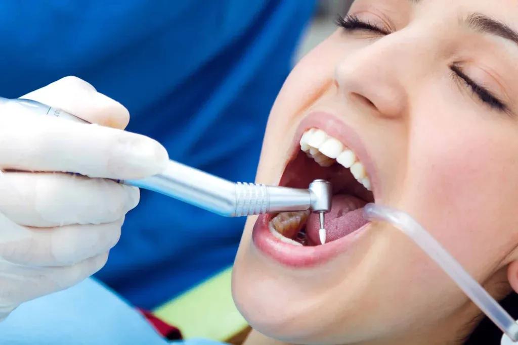composite-filling-tooth-preparation-1024x683