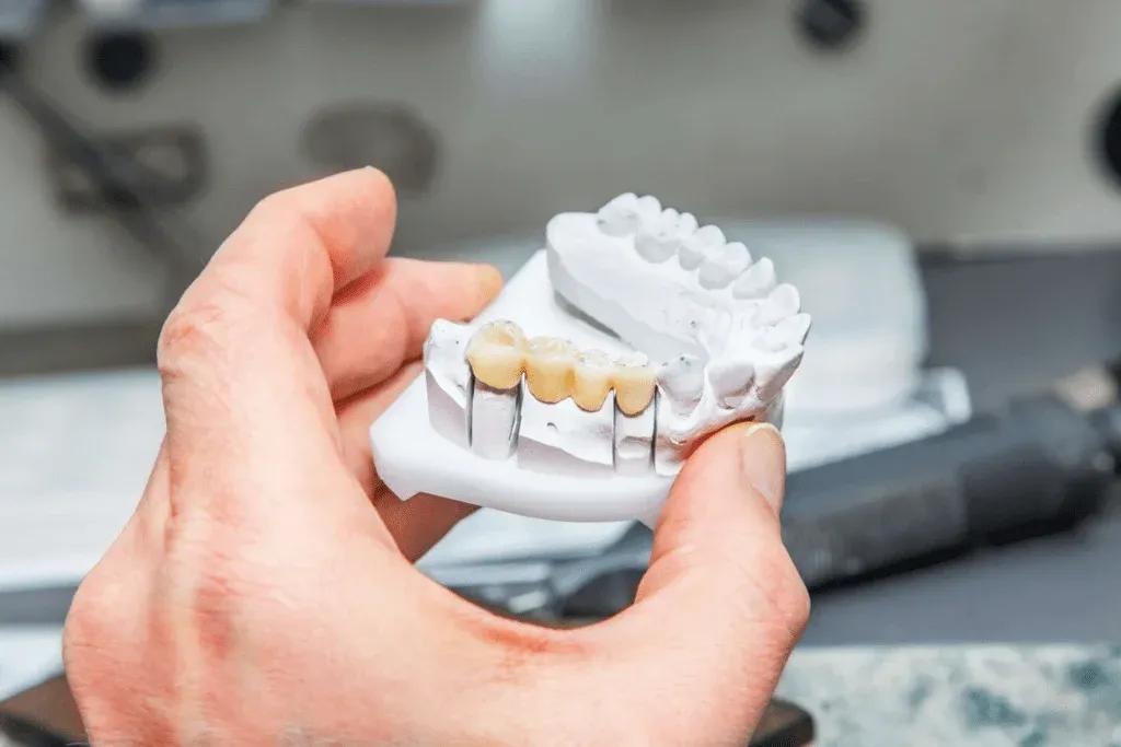 dental-bridge-model-hand-1024x683