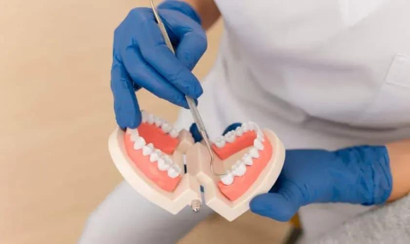 dental-composite-resin-fillings-840x500