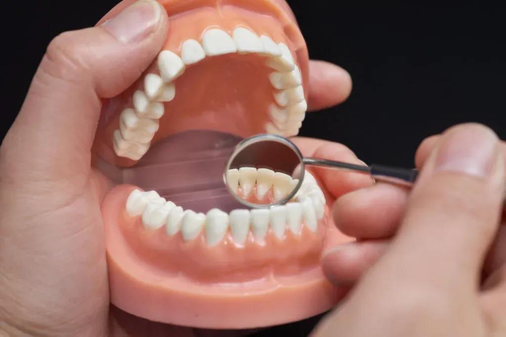 dental-crown-vs-dental-bridge-1024x683