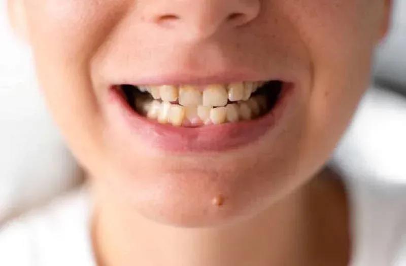 dental-issues