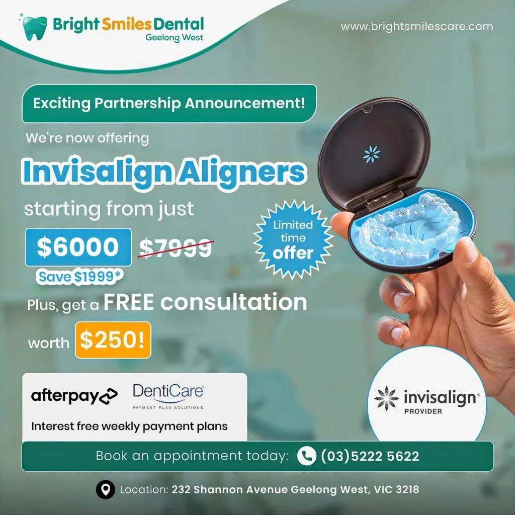 invisalign-aligners-offer