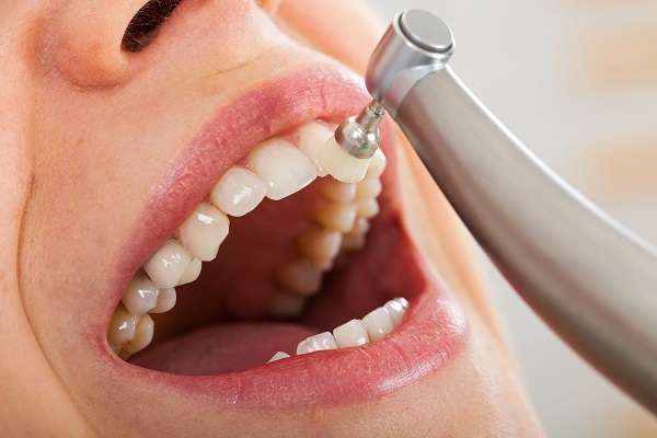 Professional teeth cleanings services