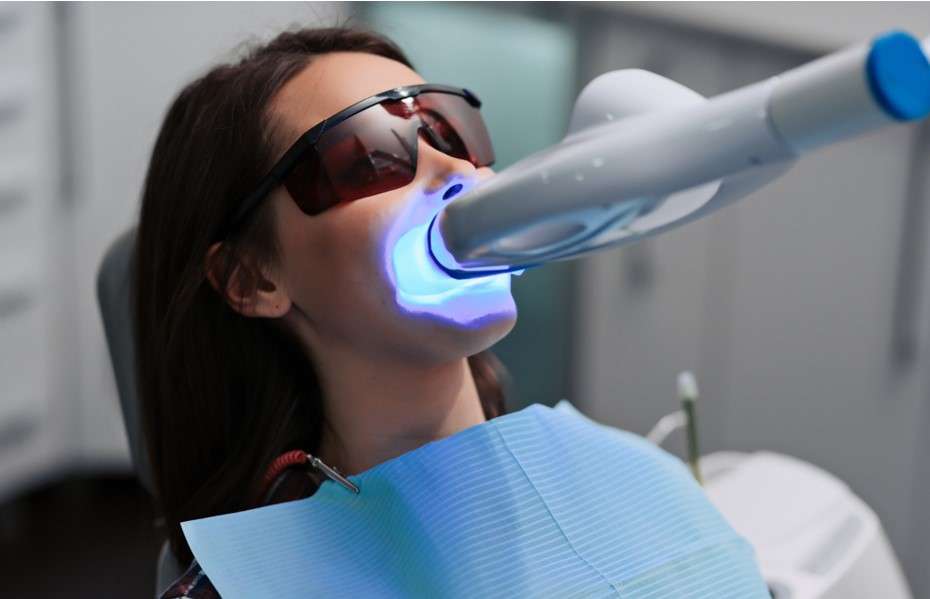 Teeth Whitening Process in Bright Smiles Dental