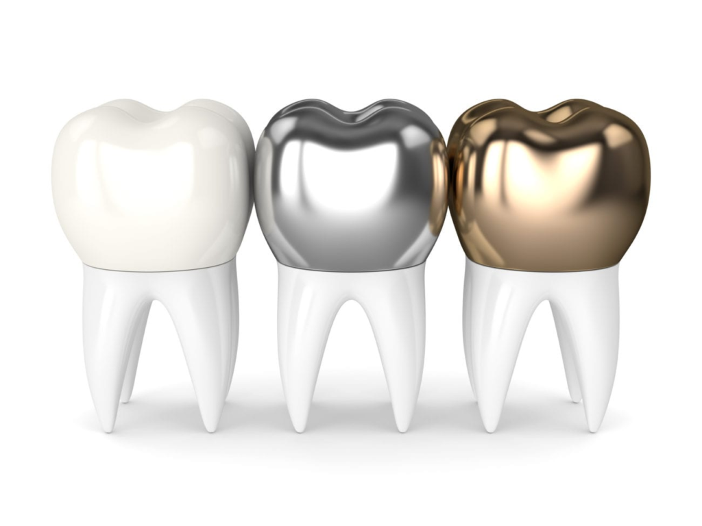 Dental Crowns Types