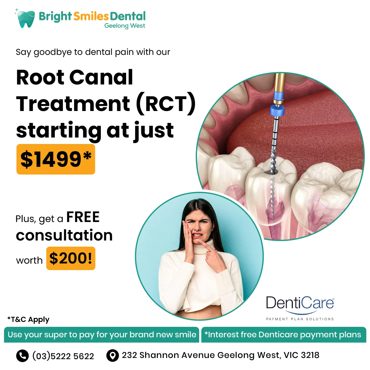 Root Canal Tratment $1499