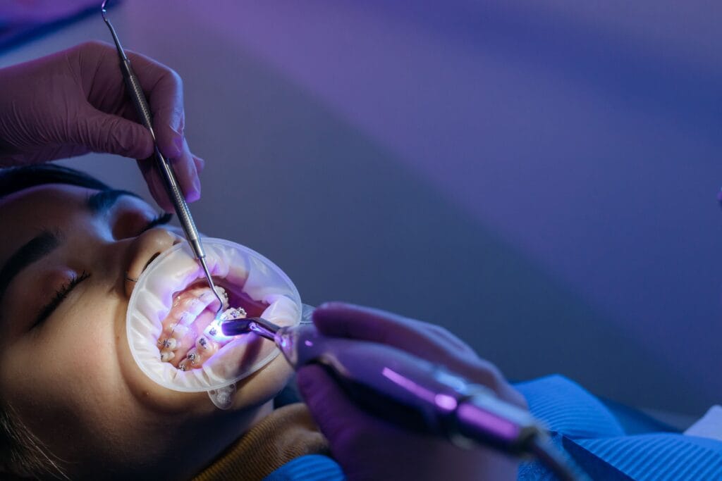 orthodontic treatment