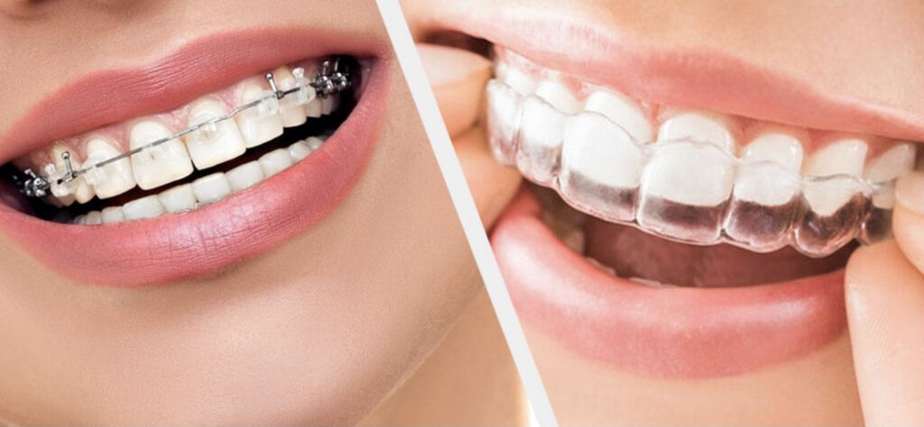 Why Patients Trust Geelong West Bright Smiles Dental for Orthodontic Needs