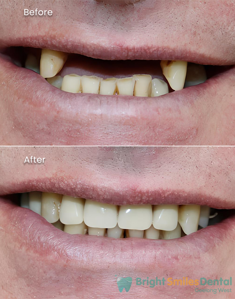 Before_After_Banner (1)